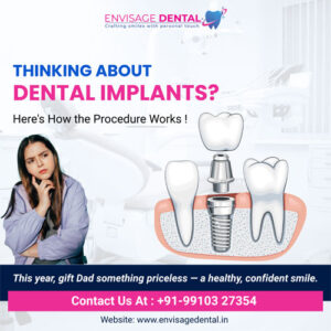 Best Dental Implant Surgeon in Noida 